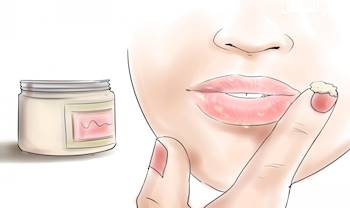 علاج الاسمرار حول الفم
