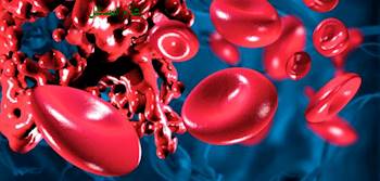  الجلطات الدموية الوريدية: التعريف-الأسباب-الوقاية و العلاج