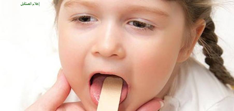  التهاب الحلق عند الأطفال: التعريف-الاسباب-الوقاية-العلاج