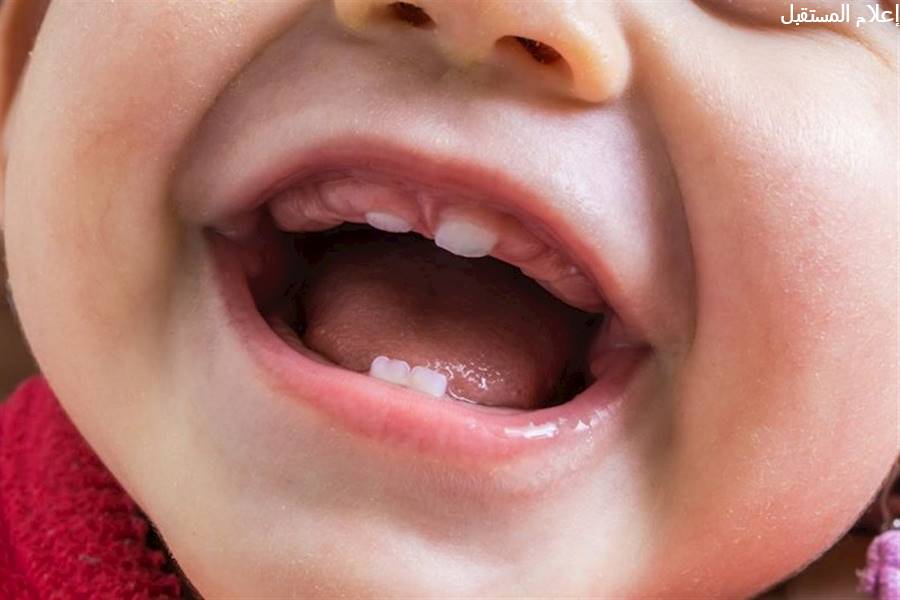 فطريات الفم عند الرضع