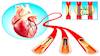 قسطرة القلب: تعريفها-الغرض منها-آلية العمل